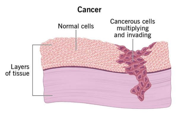 Korean wild ginseng root and anti-cancer health benefits