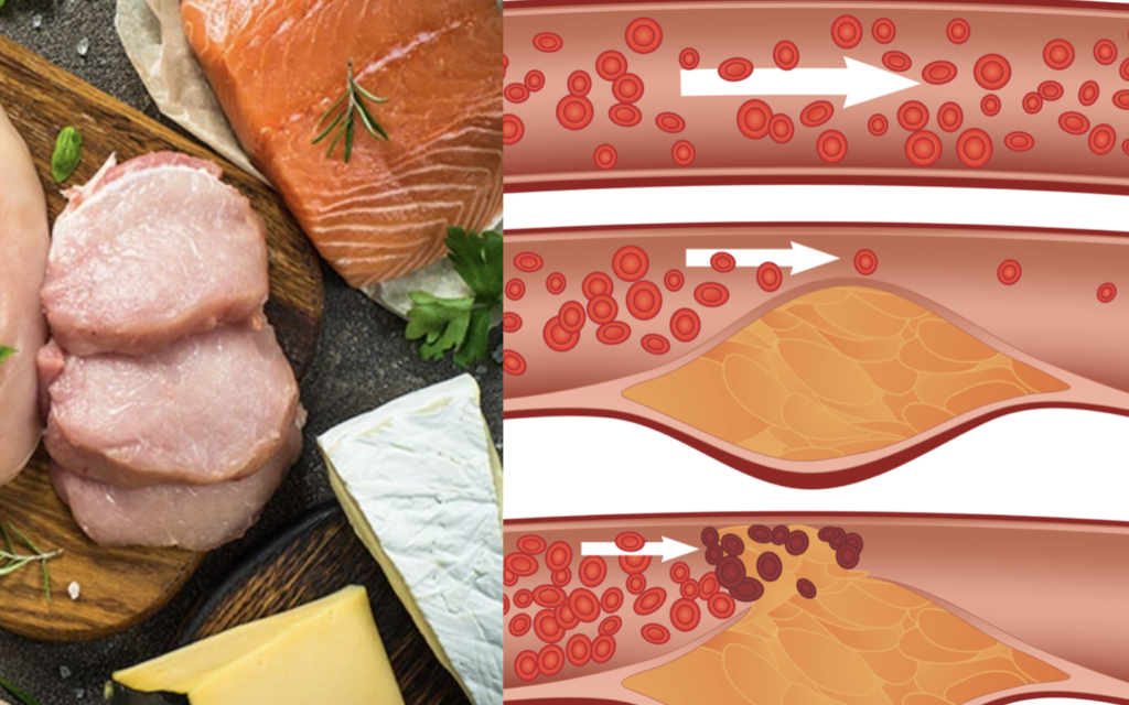 animal-protein-cholesterol-heart-health Animal protein foods and their relationship with dietary cholesterol and saturated fat