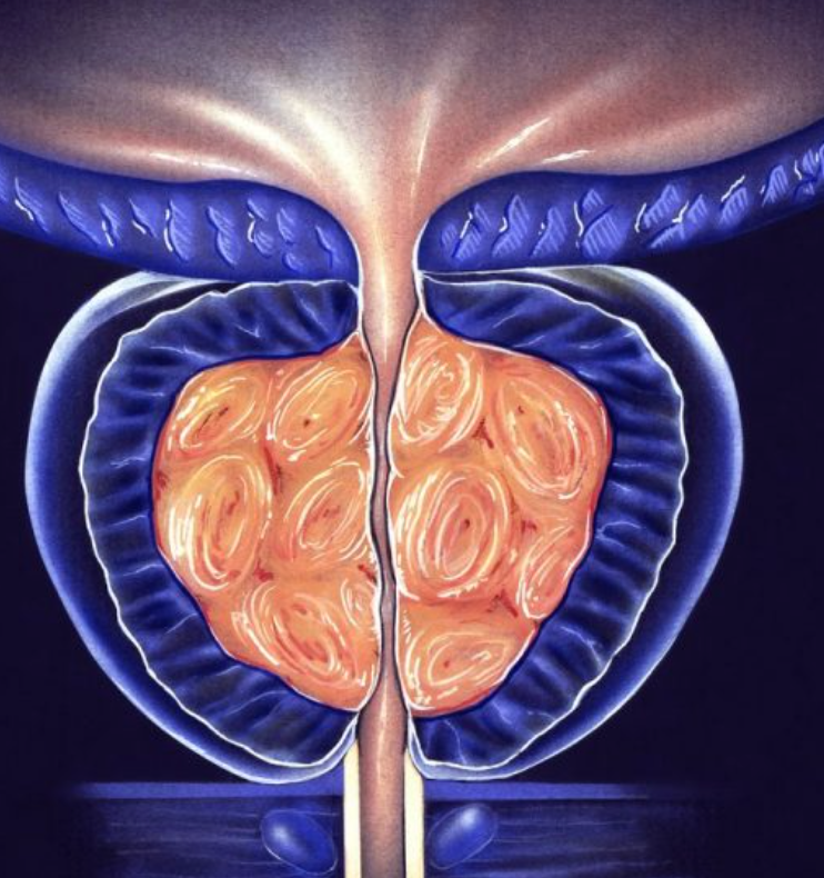 Korean ginseng root and Korean red ginseng related to prostate health research