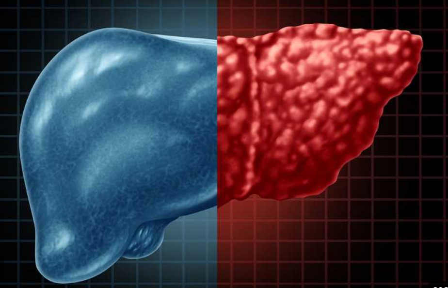 Liver detox myth versus evidence-based liver health habits