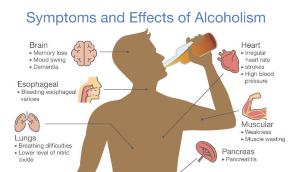Diagram showing how excessive alcohol can contribute to liver injury